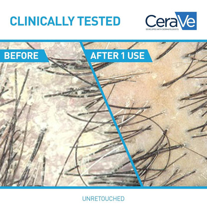 Hydrating anti Dandruff Shampoo, 1% Pyrithione Zinc Dandruff Treatment with Ceramides, Niacinamide & Hyaluronic Acid, Helps Eliminate Flakes & Provides Itchy Scalp Relief, Sulfate Free, 12 Oz